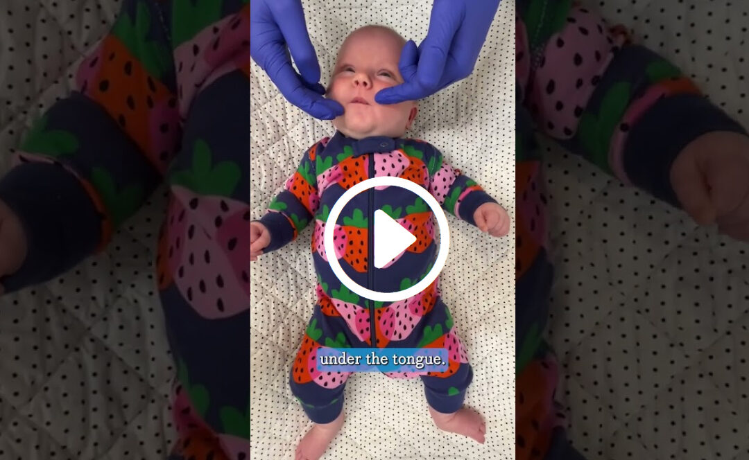 Infant Tongue Tie Stretches Demo