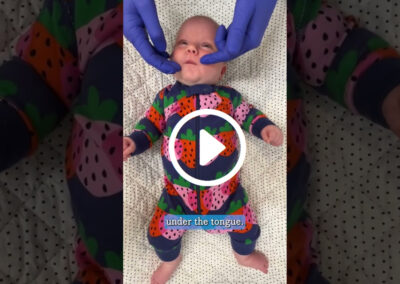 Infant Tongue Tie Stretches Demo